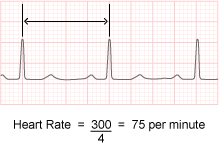 calculating_heart_rate