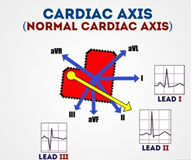 cardiac axis